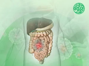 سرطان الغشاء البريتوني