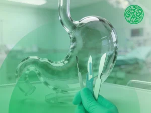 استئصال المعدة