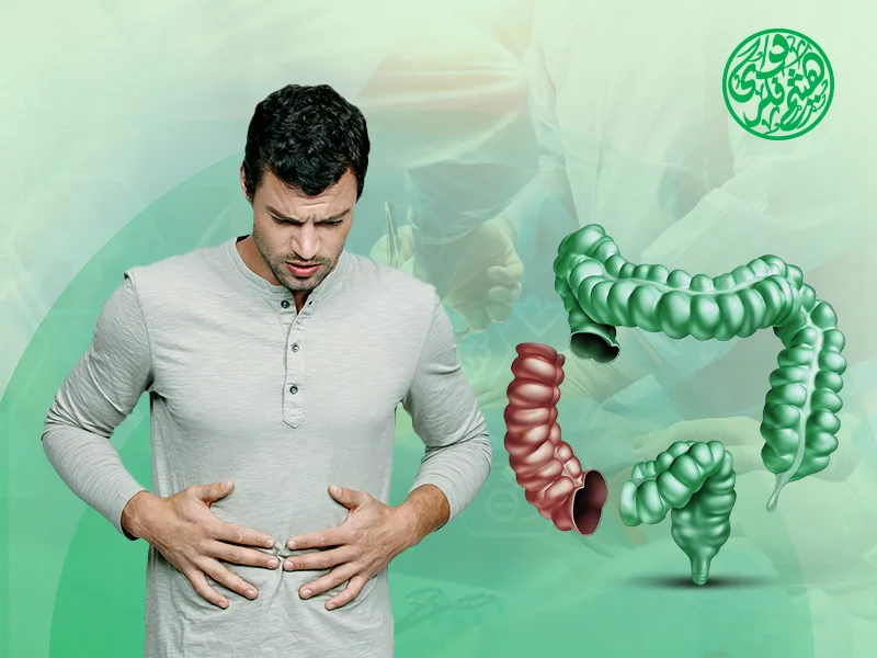 اعراض ما بعد عملية استئصال جزء من القولون