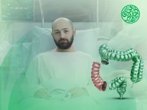بعد عملية استئصال جزء من القولون