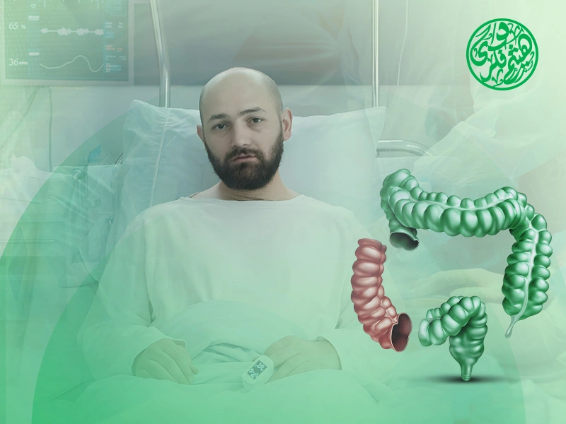 بعد عملية استئصال جزء من القولون