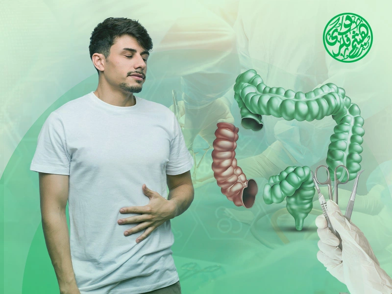 تجربتي مع استئصال جزء من القولون