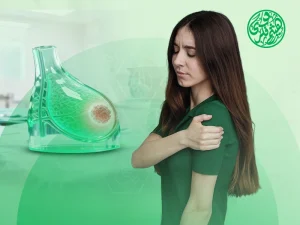 علاج تورم الذراع بعد استئصال الثدي
